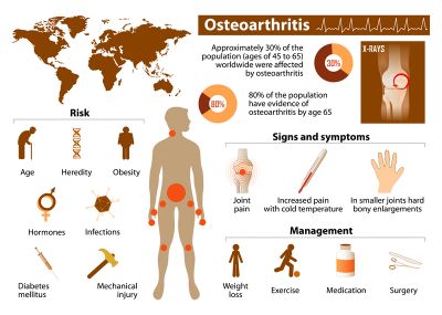 Magcell Reduces Osteoarthritic Pain and Reduces Knuckle Swelling